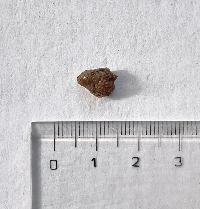 Naczelny_Borowik - Kamień nerkowy 1cm chyba jakieś wisiorki z tego porobie 
( ͡° ͜ʖ ...