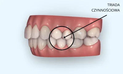 rs15 - @C13CH4N: W prawidłowym zgryzie górne zęby powinny zachodzić w 1/3 - 1/2 na do...