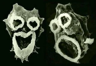 cheeseandonion - >Electron Microscope image(s) of Naegleria fowleri, the brain-eating...