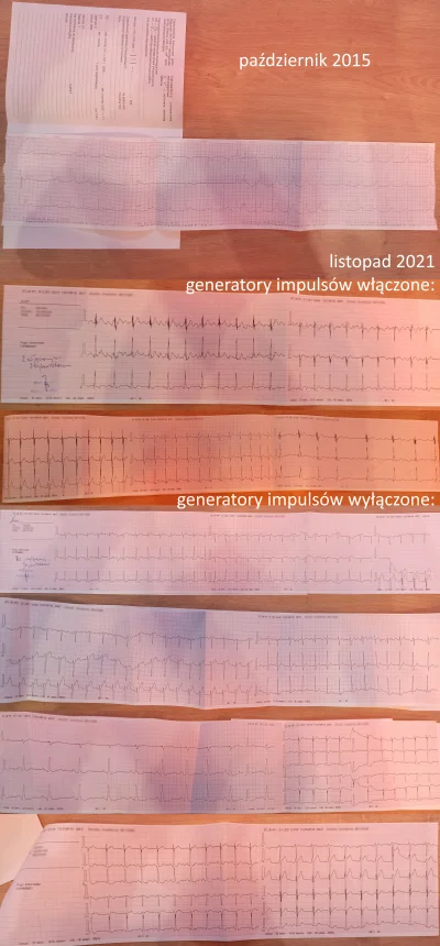 tamagotchi - @schizoidalny_introwertyk: tu jeszcze reszta EKG, jakby chciało ci się r...