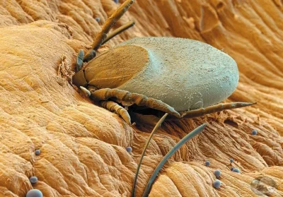 cheeseandonion - >Ticks attached to human skin

#podmikroskopem #kleszcze