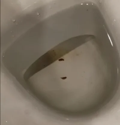 Parspakop - #robaki #insekty #toaleta #biologia 

Ma ktoś może pojęcie co to są za ...