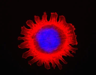 Leel00 - Dla porównania - nasz wewnętrzny mikrokosmos:
Fibroblast (komórka tkanki łą...