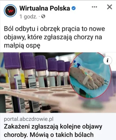 D.....r - Podejrzewam że te objawy to raczej korelacja a nie bezpośrednie następstwo ...