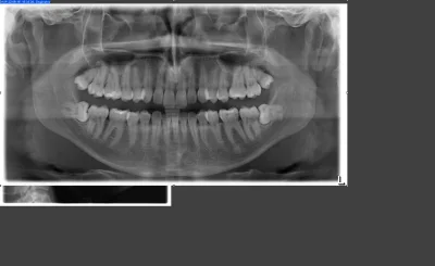 LadnyChlopczyk - #zeby #dentysta #stomatolog #ortodoncja #chirurgia 
#stomatologia #...