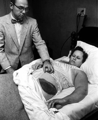 Mirxar - Ann Hodges w 1954 została trafiona przez spadający meteoryt.
#ciekawostki #...