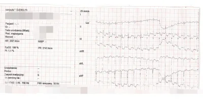 smyq - @loman_alchemik: ekg