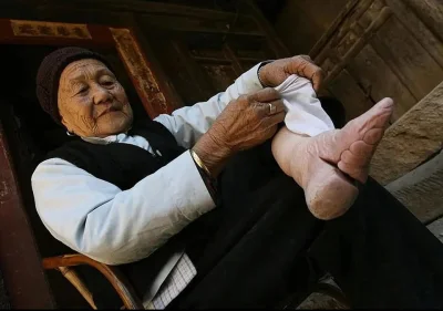 jmuhha - stopa kobiety w wyniku kulturalnego noszenia butów