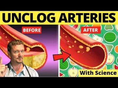 luk04330 - #keto #lowcarb

Top Foods to Clean Arteries & Prevent Heart Attack!