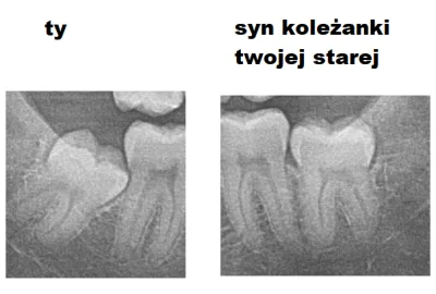 niochland - Byłem u #dentysta żeby zrobił mi zdjęcie RTG całej mordy i żebyśmy zlokal...