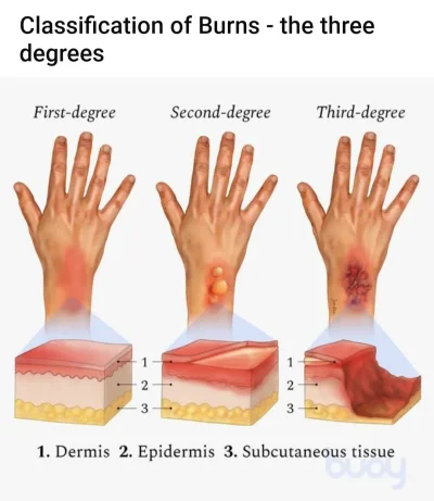 cheeseandonion - https://www.reddit.com/r/coolguides/comments/xmgjb6/classificationof...