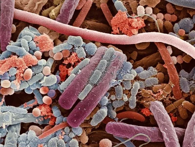 cheeseandonion - >Bacteria on the surface of a human tongue magnified 10,000x

#zbl...