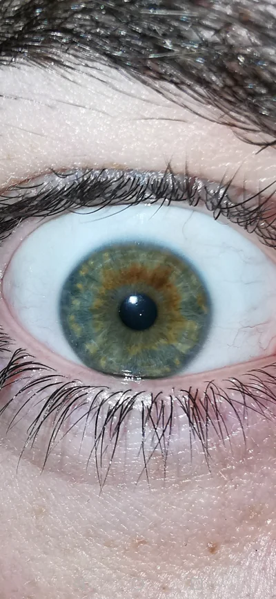 lesnydzban - Mirki jaki to jest kolor oczu?
#biologia #natura #oczyboners #zdrowie