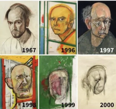 cieliczka - Autoportrety pacjenta z chorobą Alzheimera

Zainicjował ten projekt kie...