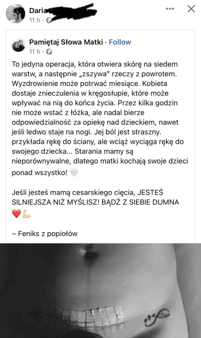 danek01 - xD 

prawdziwa kobieta rodzi tylko naturalnie!!!11


#madki #facebook #beka...