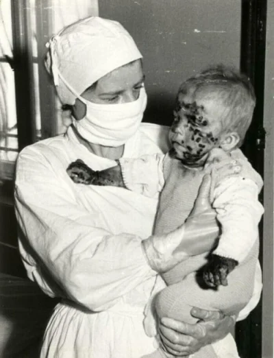 4ntymateria - Pielęgniarka z chorym dzieckiem podczas epidemii ospy.
#wroclaw, 1963. ...