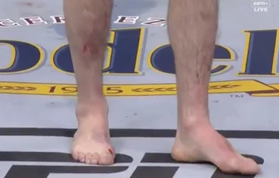 bill-adamsonn - "There will be no dancing tonight" ( ͡° ͜ʖ ͡°)
#ufc