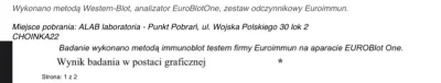 wladyslaw_stepien - Mirki czy #immunoblot to to samo co #westernbolt ? Zrobiłem badan...