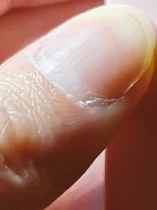 HrabiaTruposz - @Borealny: Wszystkie Twoje paznokcie są takie wypukłe? Nie masz czase...