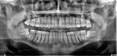 AnonimoweMirkoWyznania - #anonimowemirkowyznania 
hej, jest może jakiś dentysta z pod...