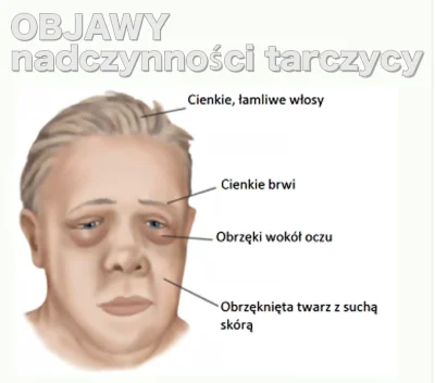 Eustachiusz - To są objawy niedoczynności tarczycy, a nie nadczynności. Profesjonaliz...