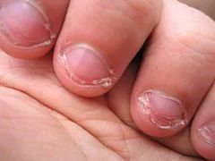 skyhenezova - @whiteglove: poobgryzane paznokcie i ogólnie zaniedbane dłonie, jak wid...