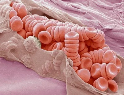nawon - Rozerwane drobne naczynie żylne pełne czerwonych krwinek

#biologia #ciekaw...