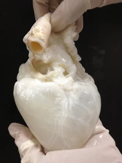 piterek - Ludzkie serce bez krwi.
#ciekawostki #biologia #anatomia