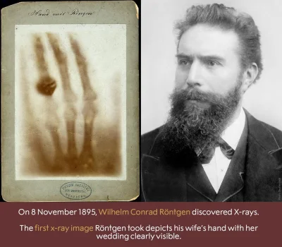 cieliczka - Tego dnia (8 listopada) w 1895 roku Wilhelm Conrad Roentgen odkrył nowy t...