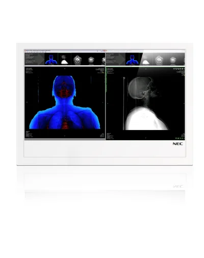 youpc - Nowy #medyczny #monitor #wielkoformatowy #nec #md461or - cyfrowy obraz w #sal...