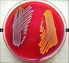 Hanysek - Staphylococcus aureus (gronkowiec złocisty) strasznie śmierdzi warto wiec z...