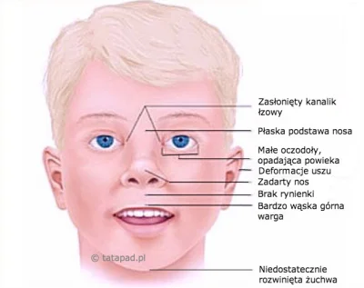 Majka94 - @Tomaszu: masz tu cechy :D może jej matka chlała w ciąży :P