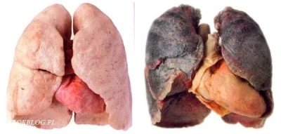 j.....a - @glosnik: masz rację, ludzkie płuco wygląda inaczej: