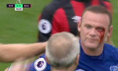 Minieri - Rooney dostał z łokcia
#mecz