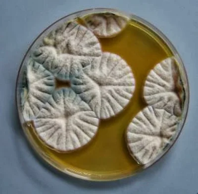 S.....r - http://www.wykop.pl/link/2006178/penetracja-tkanki-roslinnej-przez-patogen-...