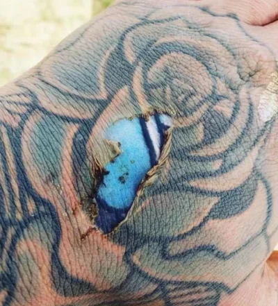 tylkoatari - typ sobie przypalił skórę i odkrył oryginalny tusz

#tatuaze #ciekawos...