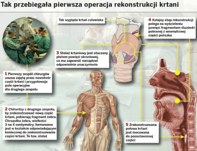 lukmal - http://www.wykop.pl/link/wykopali/667411/niesamowita-operacja-gliwickich-chi...