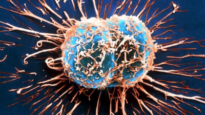 Cetus - Komórka rakowa pod mikroskopem elektronowym.

#rakcontent #fotografiaelektr...