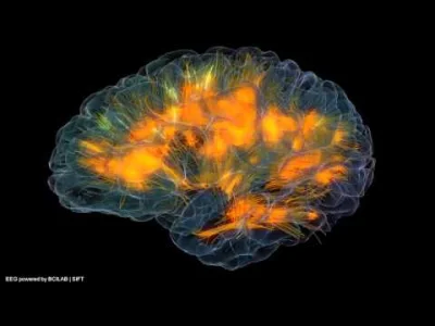 rainkiller - Na filmiku jest symulacja mózgu działania mózgu w trakcie rozwiązywania ...
