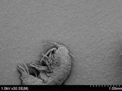 darosoldier - Na obunogu siedzi sobie okrzemka, a na niej bakteria. 
Mikroskop elekt...
