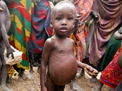 Kielek96 - @Lord6Infamous: Właśnie stąd afrykańskie dzieci które głodują mają duże br...