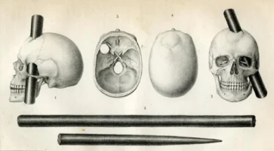 s.....3 - @stranger13: ale incepcja
http://tylkonauka.pl/wiadomosc/phineas-gage-czlo...