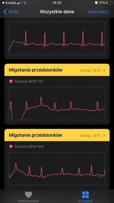 radoskor3 - Dla smieszków i niedowiarków, moja mama miała kilka razy migotanie, zrobi...