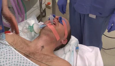 cosciekawego - Dlaczego podczas operacji zakleja się pacjentom oczy? #operacja #szpit...