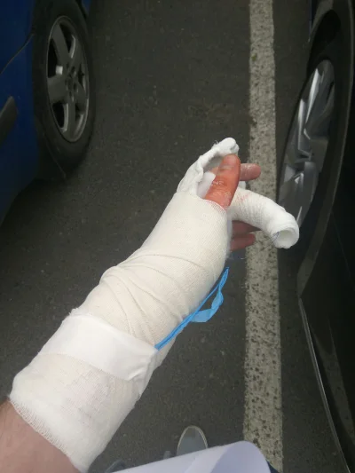 chodzacy_internet - @Perlite mi założyli po operacji taki gips. Od weekendu już bez o...