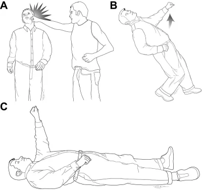 blisko_kebab - Wstrząs mózgu, fencing response.