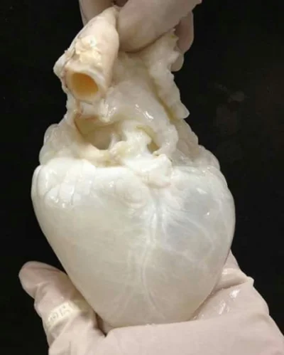 kotownik - Gdyby ktoś zastanawiał się jak wygląda serce albinosa.

#ciekawostki #na...