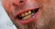 andrewt - @realitybites: lepiej żeby zebrali pieniądze na dentystę... (－‸ლ)