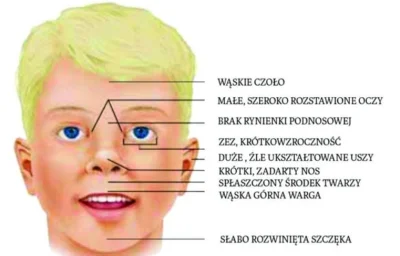 s.....2 - @Obserwatorzramienia_ONZ: sprawa nie jest taka prosta, fas naturalnie jest ...