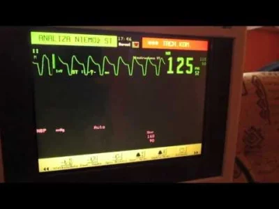 C.....m - @rybsonk: 
Tak, tylko że zapis EKG na monitorze jest aktualizowany co ileś...